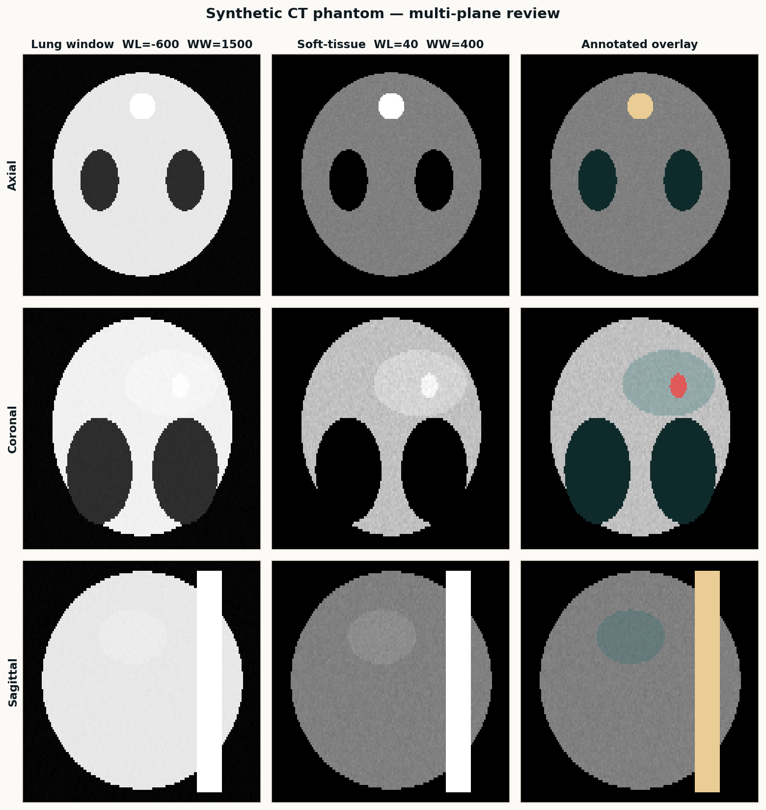 Axial, coronal, and sagittal views of a synthetic CT phantom with overlay