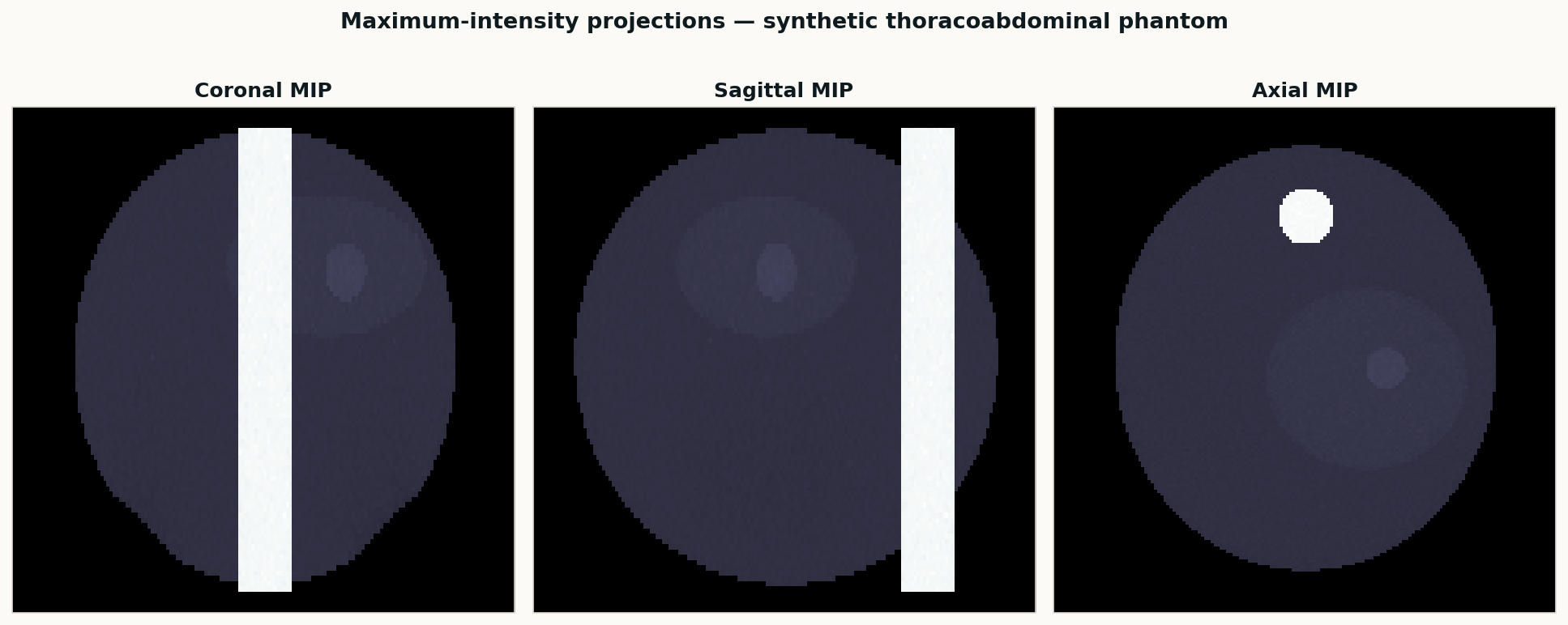 Maximum-intensity projections of the synthetic thoracoabdominal phantom